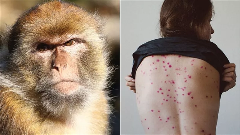 4 نصائح من الصحة العالمية.. لمواجهة 