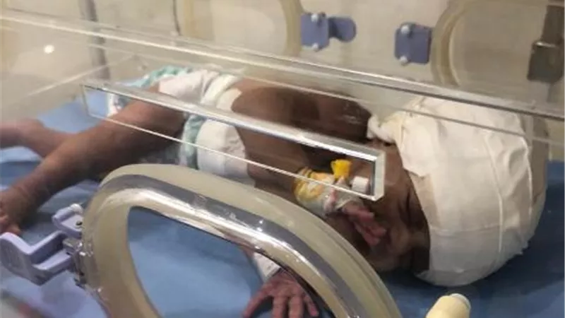 إجراء جراحة عاجلة ودقيقة بالمخ لطفلة بمركز الإيواء بالعاشر