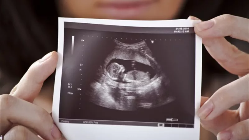 بنتيجة مؤكدة.. تعرفي على كيفية إجراء اختبار الحمل المنزلي باستخدام 