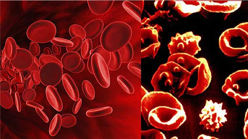 أطباء: التطورات العلاجية الأخيرة مكنتنا من السيطرة على 