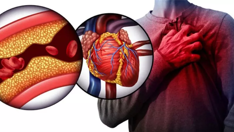 ثمرة واحدة يوميًا من هذه الفاكهة تحميك من الكوليسترول