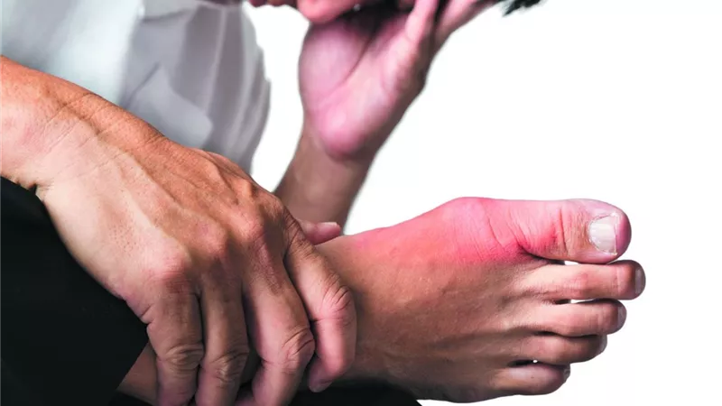 تعرف على داء الملوك