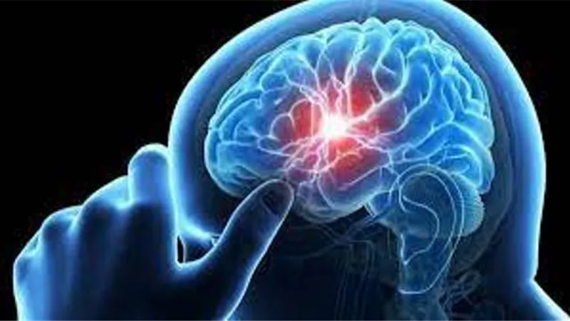 منها الاقلاع عن التدخين..7 عادات تقلل خطر الإصابة بسكتة دماغية