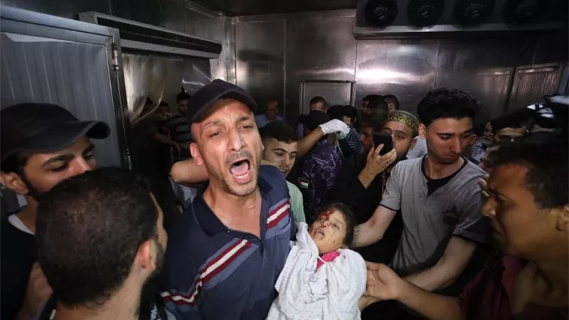 10 شهداء بينهم أطفال وعشرات الجرحى حصيلة العدوان الاسرائيلي على غزة