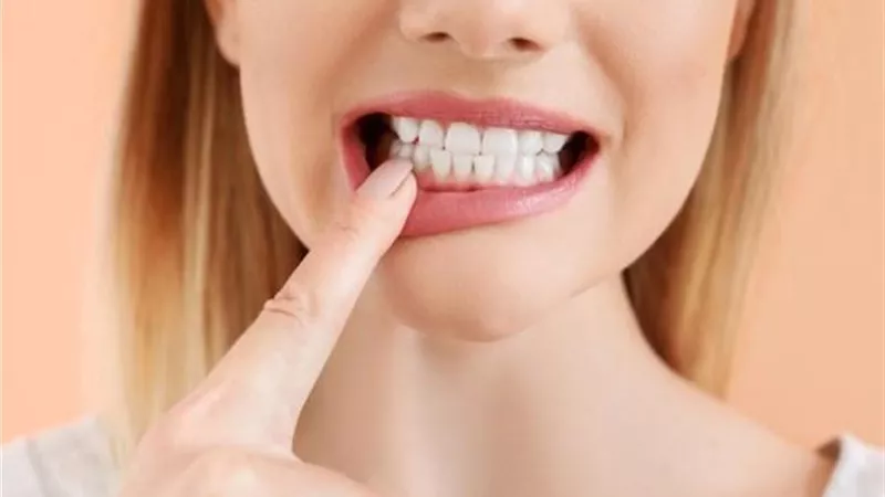 تعرف على أهم العوامل المؤثرة في حساسية الأسنان