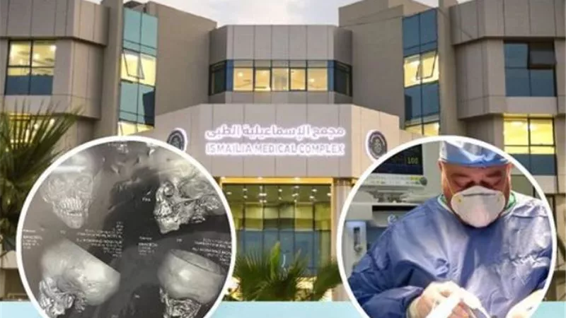 إزالة ورم بالرقبة ضاغط على فك طفل في مجمع الإسماعيلية الطبي