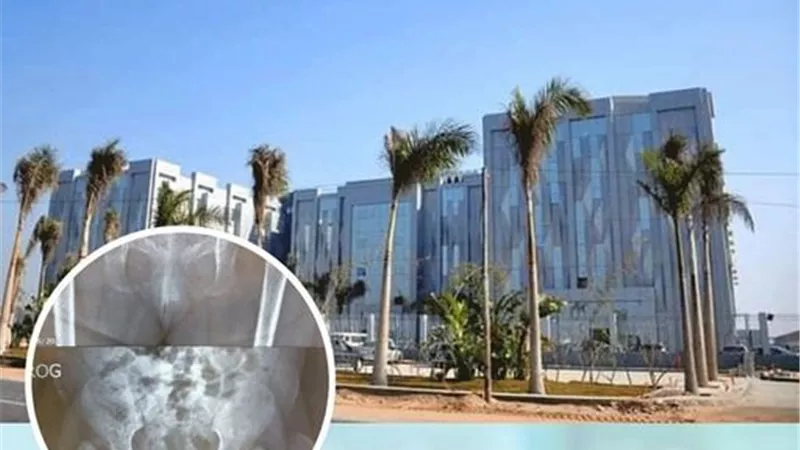 جراحتين دقيقتين تعيدان الحركة لطفلتين بمستشفى ابوخليفة في الإسماعيلية