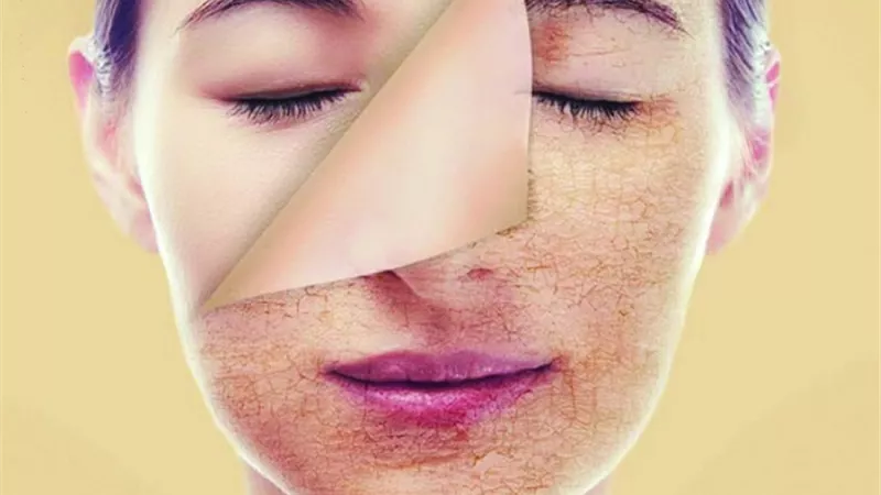 كيف تعتنى بصحة جلدك ؟ إليك 13 نصيحة هامة