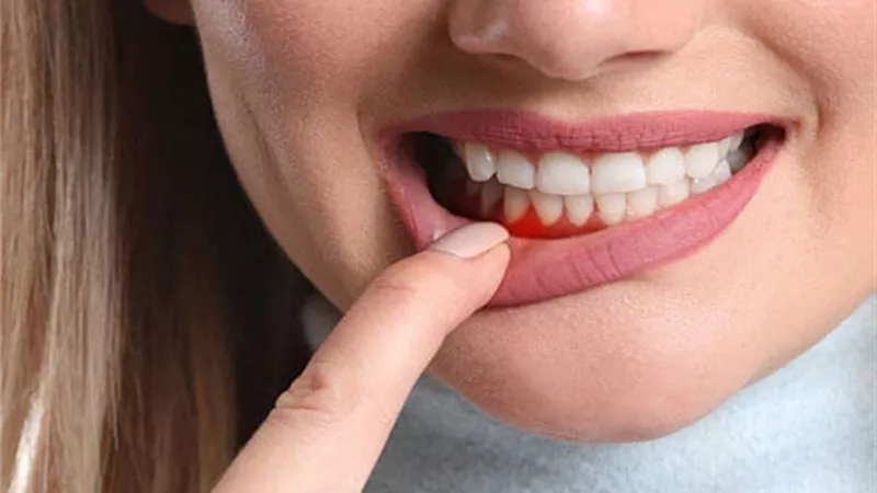 تعرف على أبرز مسببات آلام اللثة وطرق الوقاية منها