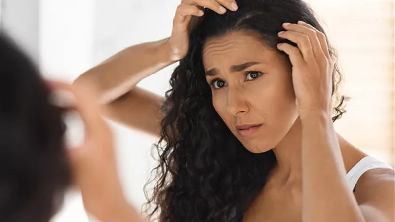 روشتة من الطبيعة تساعدك فى التخلص من قشرة الشعر.. اكتشفيها معنا