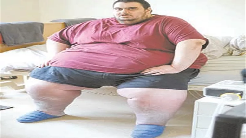 للشفط حدود