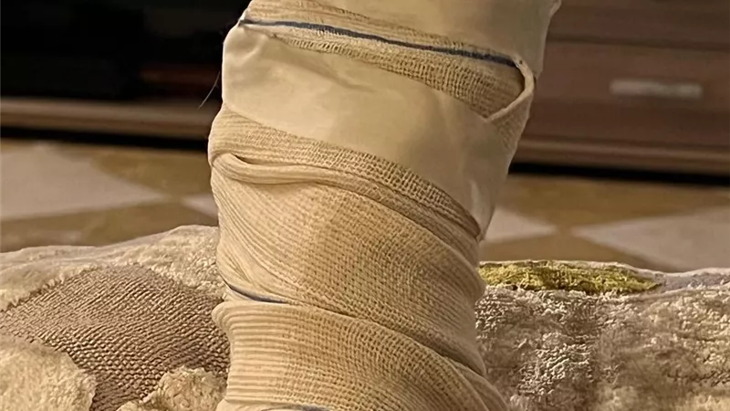 السر فى الباديكير.. منة فضالي تخضع لعملية جراحية فى قدمها