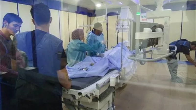 أستهداف أجراء 34عمليات قلب للمرضى غير القادرين ببني سويف