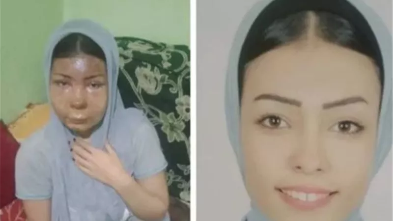 تجديد حبس شاب سكب مياه نار على وجه فتاة وجدتها لرفضهما خطبته