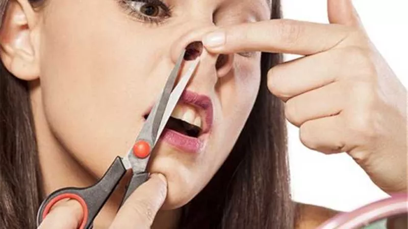 احذر.. إزالة شعر العنف باستمرار يصيب المخ بأضرار خطيرة