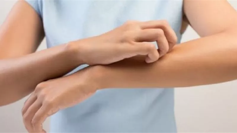 العلاج المنزلى لحساسية اليدين من الصابون