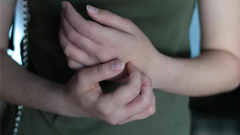 احذرمن الاصابة بهذه الأمراض الجلدية المعدية