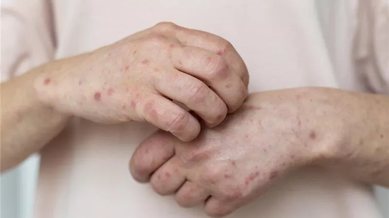 الأرجنتين تسجل أول حالة وفاة بفيروس 