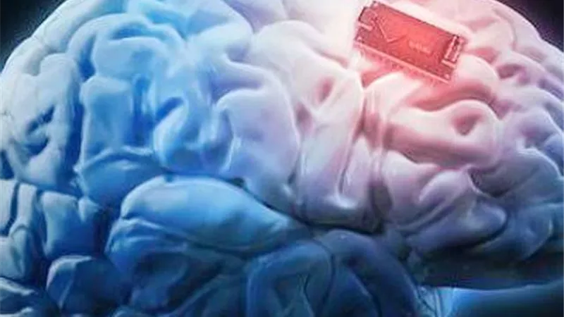 شرائح إلكترونية في الدماغ البشرية