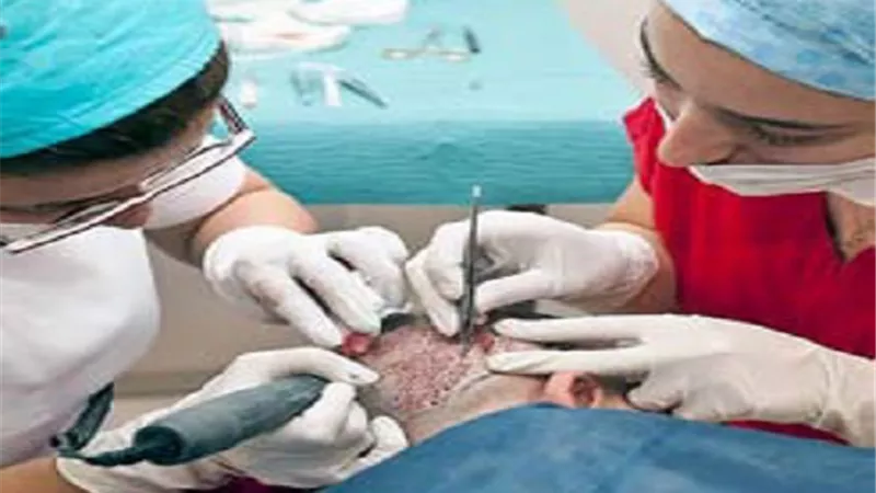 هندي يدفع حياته.. ثمنًا لزراعة الشعر