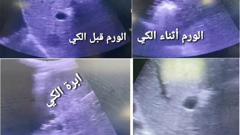 تقنيات متطورة بوحدة الآشعة التداخلية بمستشفي سوهاج الجامعي..صور