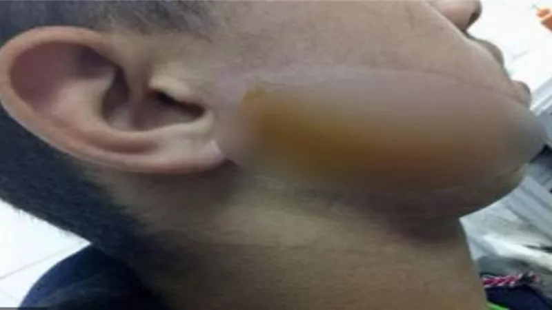 طالب يتعدى على زميلة بموس في الوجه بأسوان