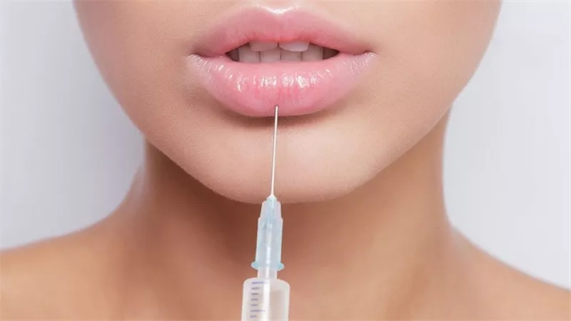 نفخت شفتيها بأقل التكاليف فحدث ما لم يكن في الحسبان.. صور