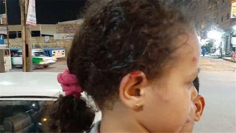 كلب ضال يعقر 8 أشخاص فى قرية بالبحيرة