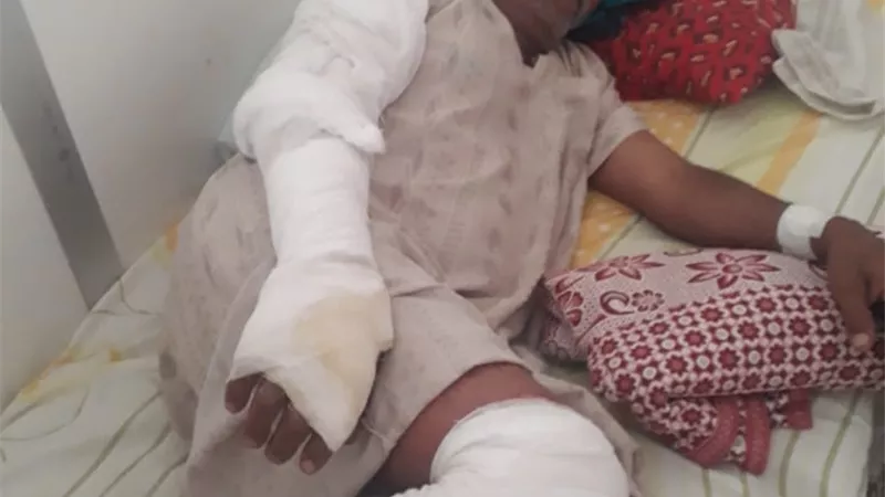 اصابة شخص ونفوق 7 رؤوس ماشية في حريق حظيرة مواشي بطنطا