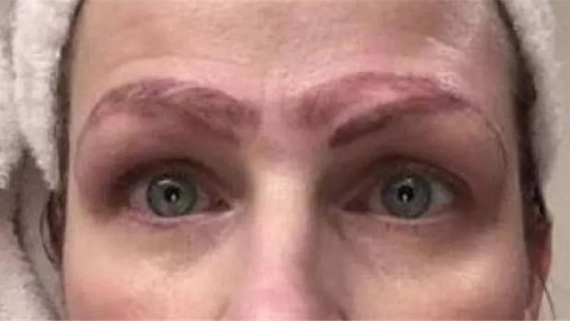 خضعت لعملية تجميل لحاجبيها.. فخرجت 