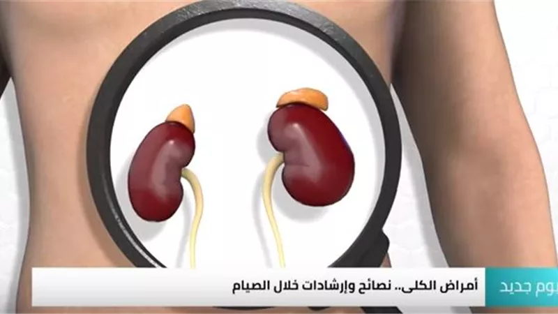 تعرف على النصائح والإرشادات لمرضى الكلي خلال الصيام.. فيديو
