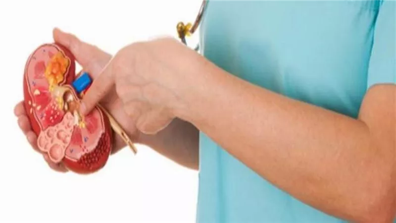 7 وصفات منزلية لعلاج حصى الكلى ..أهمها الرمان والريحان