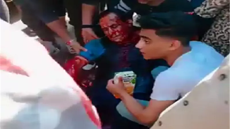 ضبط 3 متهمين في واقعة التعدي علي شخص بالاسلحة والخرطوش في العيد بالمنصورة