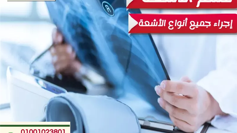 مستشفى جاويش تقدم جميع أنواع وخدمات الأشعة مدار 24 ساعة