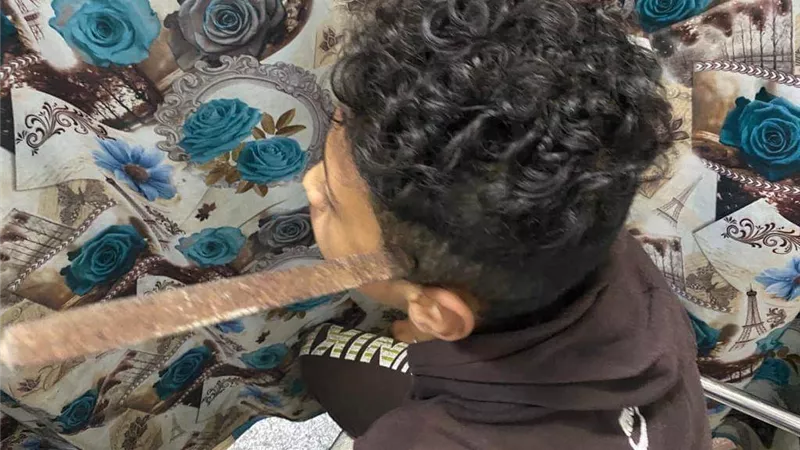 جراحة عاجلة في طوارئ المنصورة لإنقاذ طالب استقر في رأسه مبرد حديد