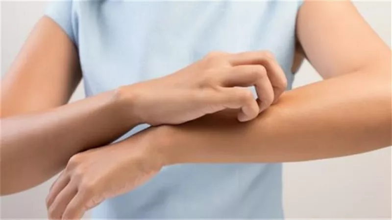 5 أعراض للحساسية من البرد .. وهذه طرق الوقاية