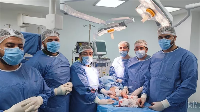 نجاح علاج تشوه وإعوجاج الساقين لطفل العظم الزجاجى بالمنوفية