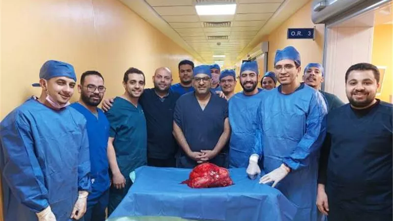 جامعة أسيوط تعلن عن نجاح فريق طبي في استئصال ورم خبيث يزن 20 كجم