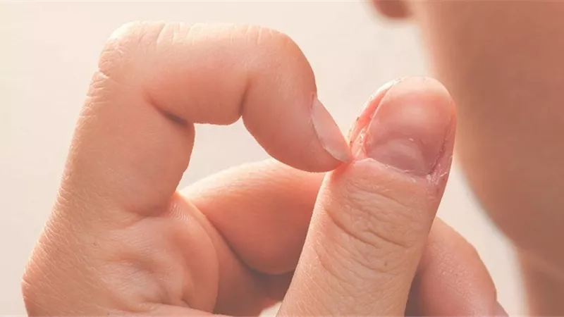 7 أسباب لعدم نمو الأظافر بالمعدل الطبيعي