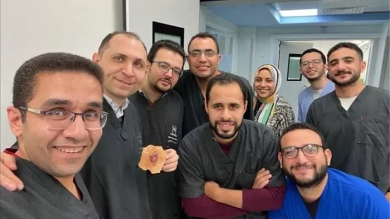 مستشفى بدر الجامعى تنجح فى إستئصال ورم بدون جراحة.. بالتفاصيل