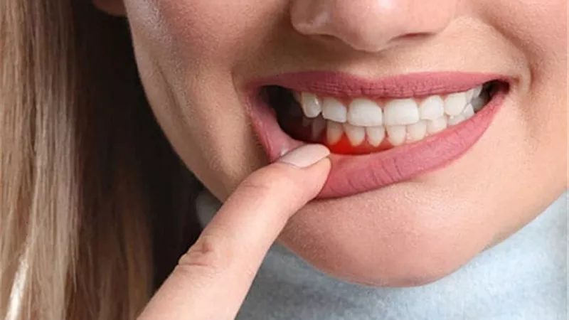 كيف تستخدم الماء كعلاج لآلام اللثة ؟ إليك طريقة مُجربة