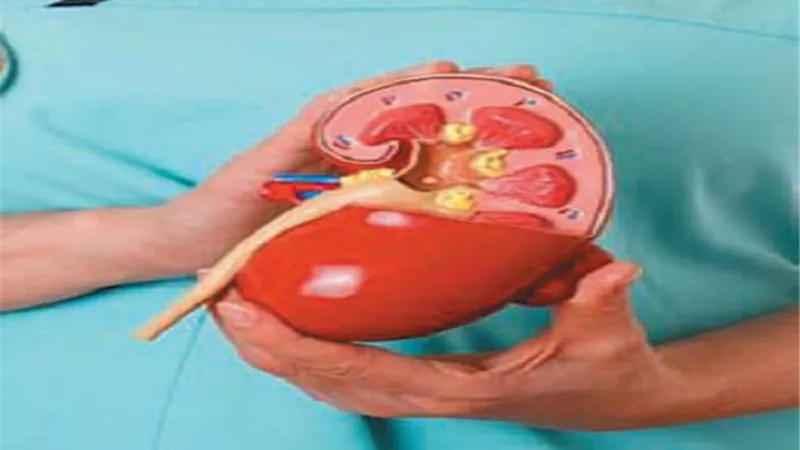 اكتشاف معدن سام يتسلل لخلايا الكلي