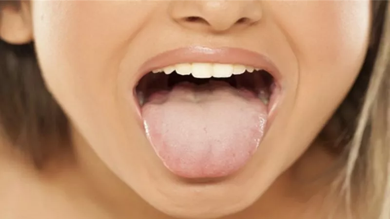 احذر من شحوب اللسان .. وهذه هى الأسباب