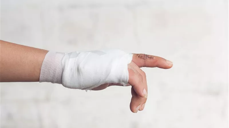 الإسعافات الأولية التي يجب اتباعها عند التعرض لعضة كلب