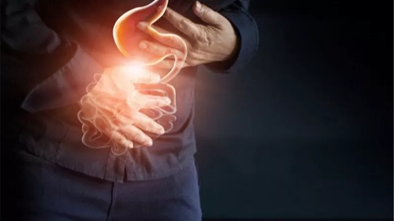 أسباب حرقة المعدة أثناء صيام رمضان