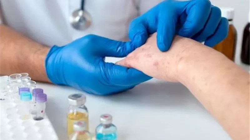 4 أسباب للاصابة بكدمات الجسم