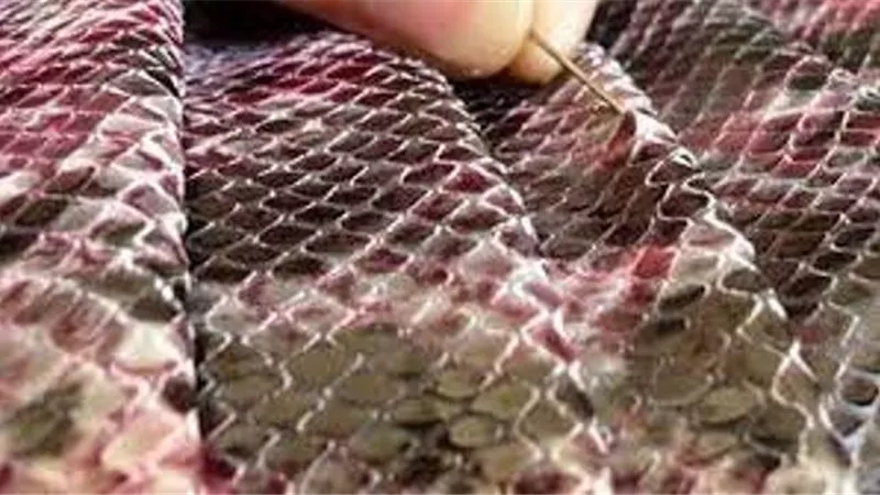 لأول مرة علاجا جديدا لضحايا الحروق باستخدام جلد سمكة