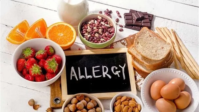 احذر تقديم هذه الأطعمة لطفلك لتجنب اصابته بالحساسية