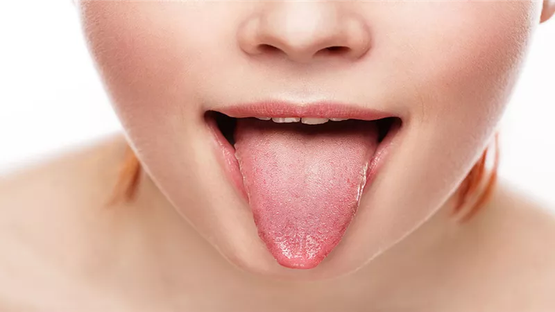 لسانك مرآة صحتك العامة.. إليك الأسباب