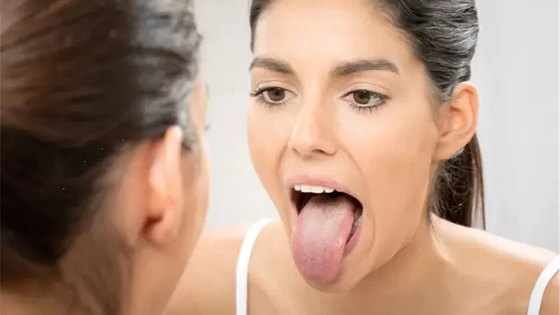 من نقص التغذية إلى السرطان .. لون اللسان يشير لمرض تعانى منه